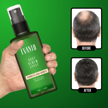 Root Renew Spray + Kit